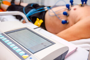 ECG- Cardiac Dynamics
