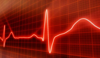 cardiac-ecg-service2