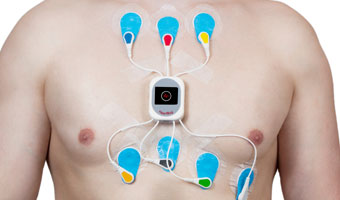 24 Hr Holter